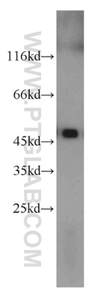 UQCRC2 Antibody in Western Blot (WB)