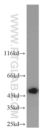 UQCRC2 Antibody in Western Blot (WB)