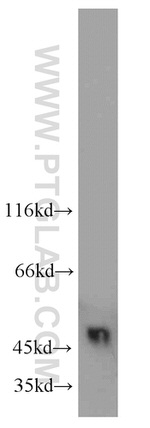 UQCRC2 Antibody in Western Blot (WB)