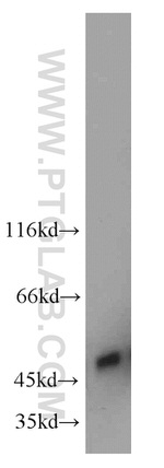 UQCRC2 Antibody in Western Blot (WB)