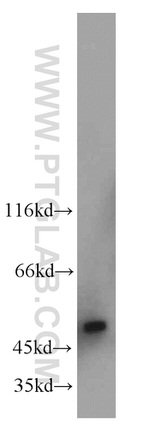 UQCRC2 Antibody in Western Blot (WB)