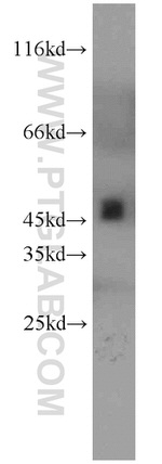 UQCRC2 Antibody in Western Blot (WB)