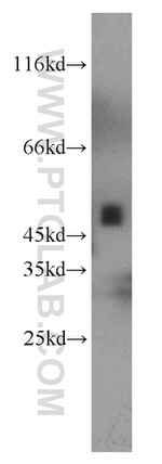 UQCRC2 Antibody in Western Blot (WB)