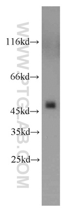 UQCRC2 Antibody in Western Blot (WB)