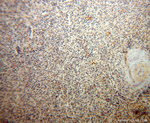 ACVRL1 Antibody in Immunohistochemistry (Paraffin) (IHC (P))