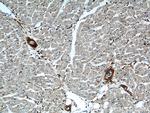 ACVRL1 Antibody in Immunohistochemistry (Paraffin) (IHC (P))