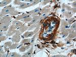 ACVRL1 Antibody in Immunohistochemistry (Paraffin) (IHC (P))