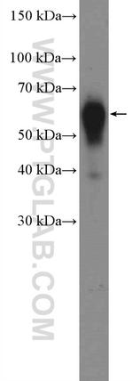 ACVRL1 Antibody in Western Blot (WB)