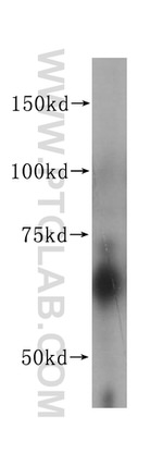 ACVRL1 Antibody in Western Blot (WB)