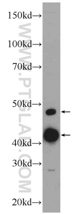 CLP1 Antibody in Western Blot (WB)