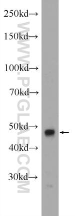 CLP1 Antibody in Western Blot (WB)