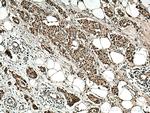 PSMD2 Antibody in Immunohistochemistry (Paraffin) (IHC (P))