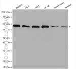 PSMD2 Antibody in Western Blot (WB)