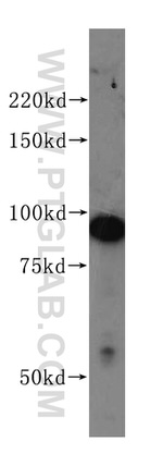 PSMD2 Antibody in Western Blot (WB)