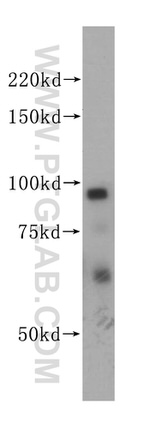 PSMD2 Antibody in Western Blot (WB)