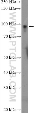 PSMD2 Antibody in Western Blot (WB)