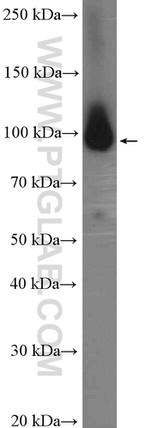 PSMD2 Antibody in Western Blot (WB)