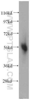 CORO1C Antibody in Western Blot (WB)