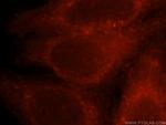 CORO1C Antibody in Immunocytochemistry (ICC/IF)