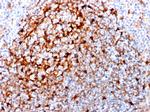 Cystatin A Antibody in Immunohistochemistry (Paraffin) (IHC (P))