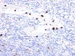 Cystatin A Antibody in Immunohistochemistry (Paraffin) (IHC (P))