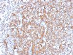 Cystatin A Antibody in Immunohistochemistry (Paraffin) (IHC (P))