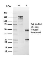 Cystatin A Antibody in SDS-PAGE (SDS-PAGE)