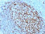 Cystatin A Antibody in Immunohistochemistry (Paraffin) (IHC (P))