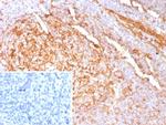 Cystatin A Antibody in Immunohistochemistry (Paraffin) (IHC (P))