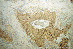 OSBPL2 Antibody in Immunohistochemistry (Paraffin) (IHC (P))