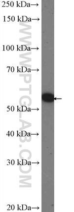 OSBPL2 Antibody in Western Blot (WB)