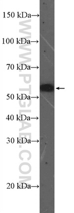 OSBPL2 Antibody in Western Blot (WB)