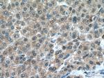 PSMC5 Antibody in Immunohistochemistry (Paraffin) (IHC (P))