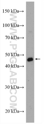 PSMC5 Antibody in Western Blot (WB)