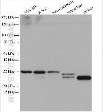 COMT Antibody in Western Blot (WB)