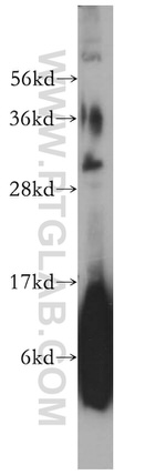 COMT Antibody in Western Blot (WB)