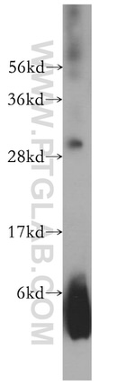 COMT Antibody in Western Blot (WB)