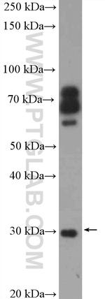 COMT Antibody in Western Blot (WB)