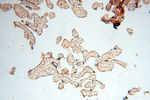 ACAT2 Antibody in Immunohistochemistry (Paraffin) (IHC (P))