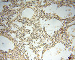 ACAT2 Antibody in Immunohistochemistry (Paraffin) (IHC (P))