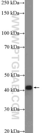 ACAT2 Antibody in Western Blot (WB)