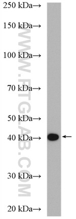 ACAT2 Antibody in Western Blot (WB)