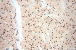 WRAP53 Antibody in Immunohistochemistry (Paraffin) (IHC (P))