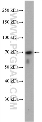 WRAP53 Antibody in Western Blot (WB)