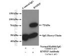 RNPEP Antibody in Immunoprecipitation (IP)