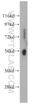 PWP1 Antibody in Western Blot (WB)