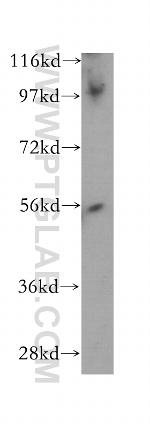 PWP1 Antibody in Western Blot (WB)