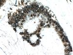 FEN1 Antibody in Immunohistochemistry (Paraffin) (IHC (P))