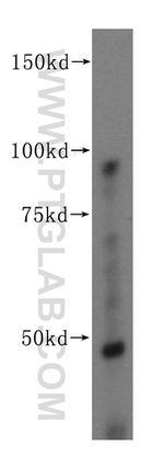 FEN1 Antibody in Western Blot (WB)