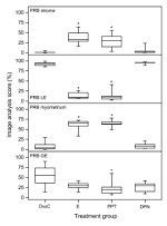 Progesterone Receptor Antibody in Immunohistochemistry (IHC)